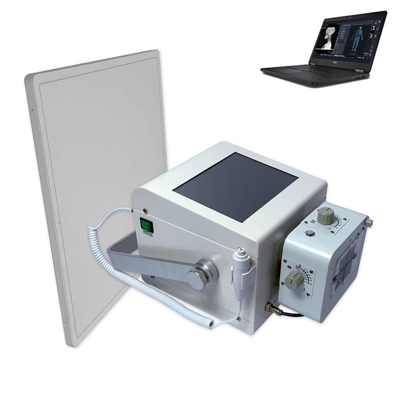 د 5kw پورټ ایبل ایکس رے ماشین