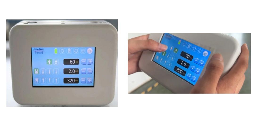 Portabilis Handheld Mobile Digital Radiography System Unlocks Multi‑Scenario Diagnostic Solutions