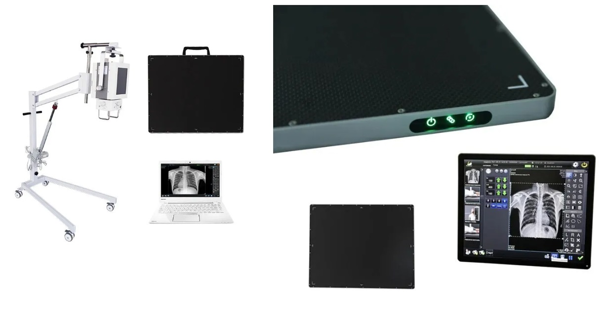 Portability harnessed Mobile Radiology How Robust Is The Portable DR