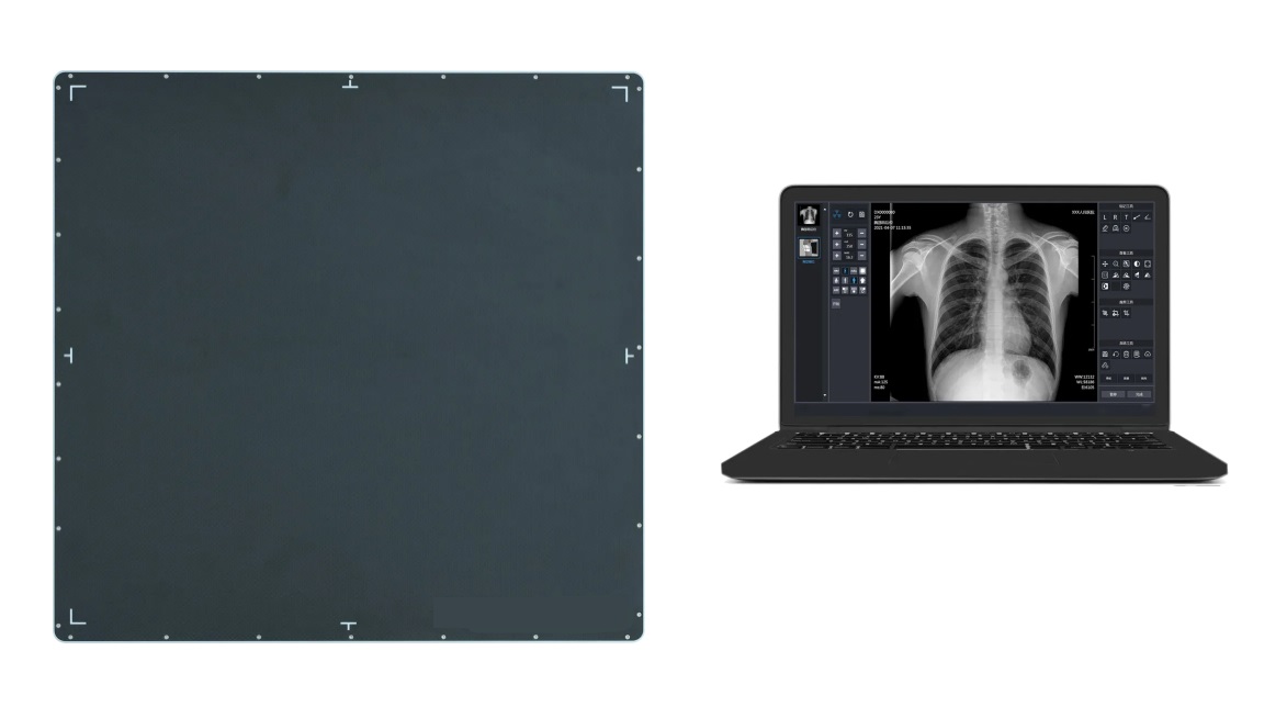 Obtainable X ray Upgrade Flat Panel Detector Low Dose High‑Speed High Resolution Imaging