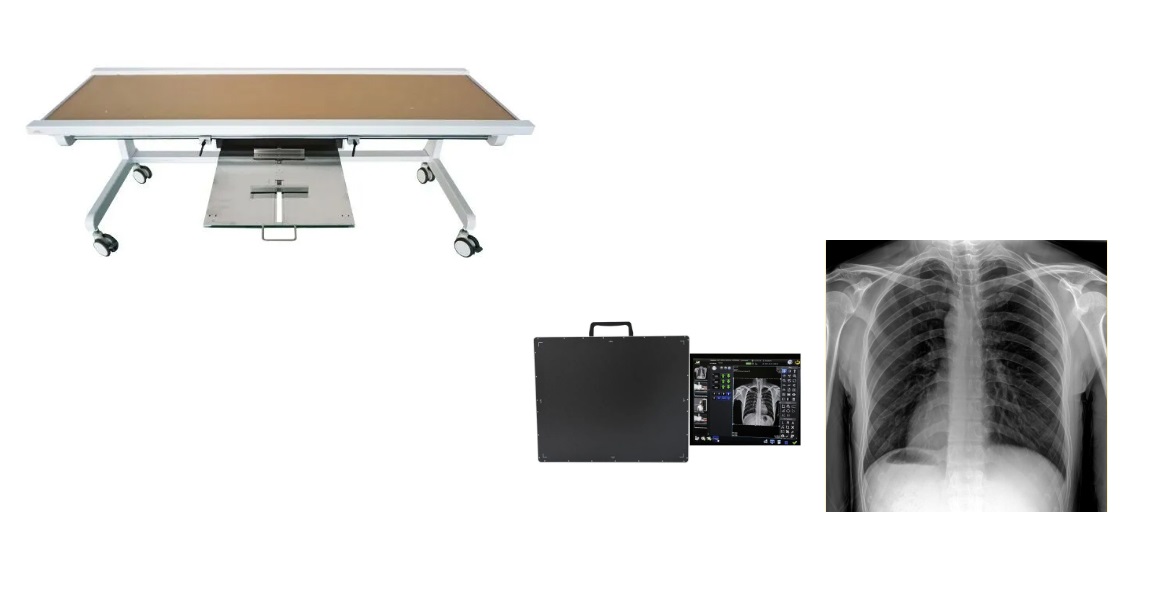 Envisage Medical X Ray Radiographic Table Empowers Full Scenario Examinations In Radiology Departments