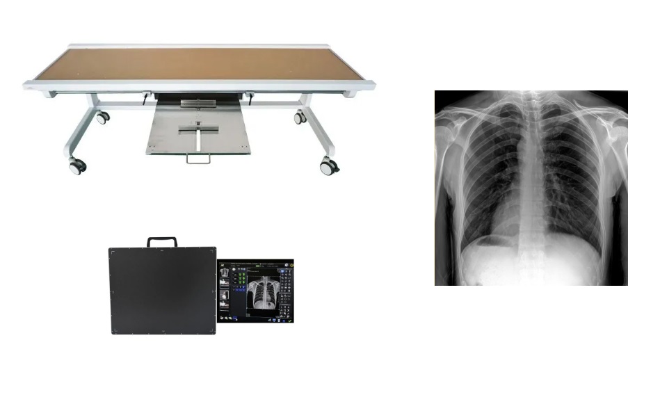 Luminant X Ray Radiographic Table Empowers Full-Scene Radiology Examinations